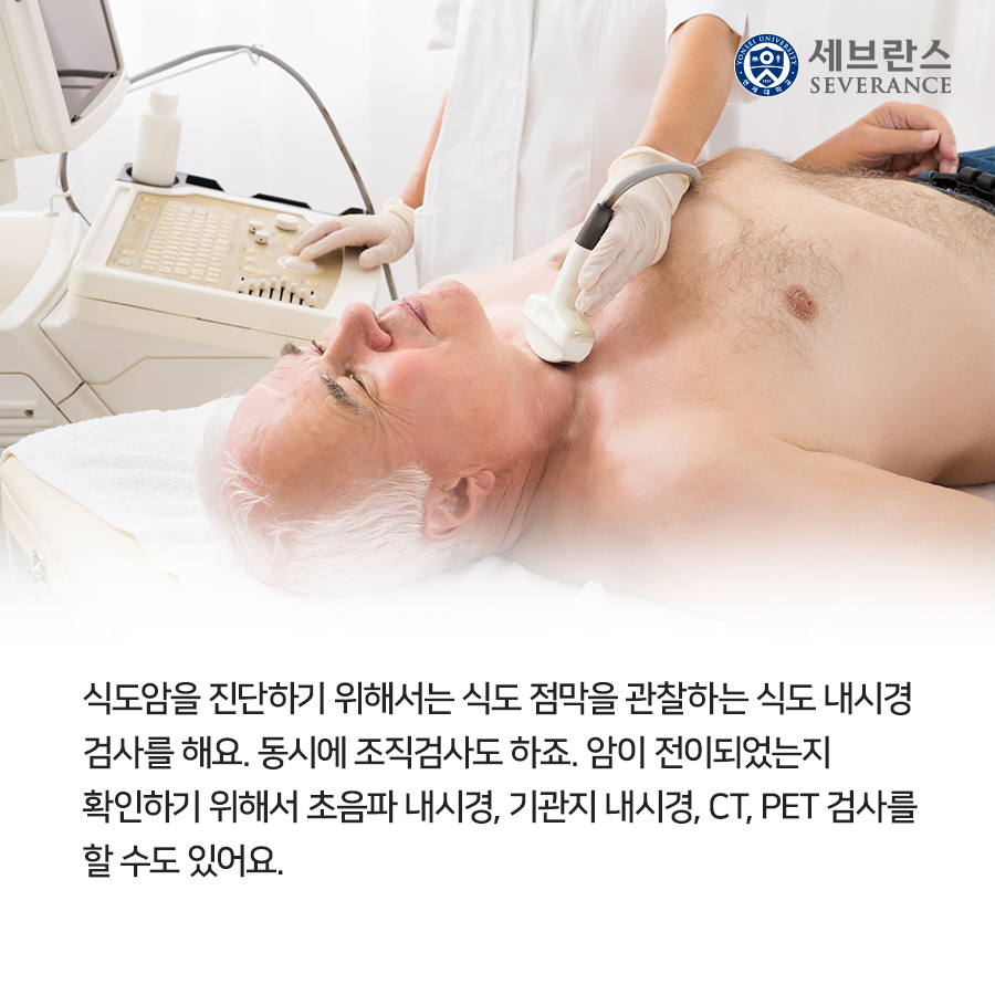 식도암을 진단하기 위해서는 식도 점막을 관찰하는 식도 내시경 검사를 해요. 동시에 조직검사도 하죠. 암이 전이되었는지 확인하기 위해서 초음파 내시경, 기관지 내시경, CT, PET 검사를 할 수도 있어요.