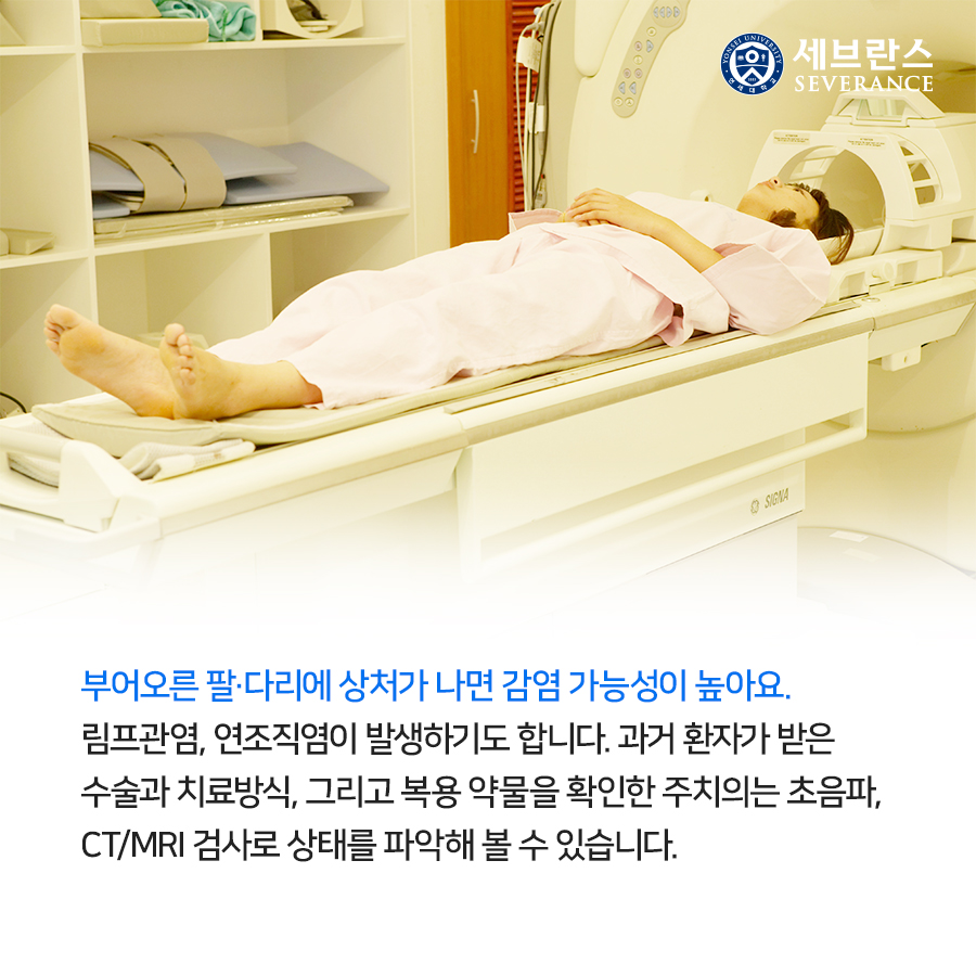 부어오른 팔·다리에 상처가 나면 감염 가능성이 높아요. 림프관염, 연조직염이 발생하기도 합니다.  과거 환자가 받은 수술과 치료방식, 그리고 복용 약물을 확인한 주치의는 초음파, CT/MRI 검사로 상태를 파악해 볼 수 있습니다. 