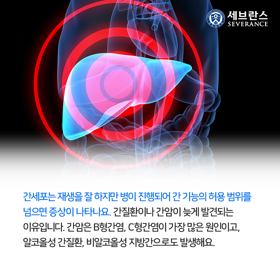 간세포는 재생을 잘 하지만 병이 진행되어 간 기능의 허용 범위를 넘으면 증상이 나타나요. 간질환이나 간암이 늦게 발견되는 이유입니다. 간암은 B형간염, C형간염이 가장 많은 원인이고, 알코올성 간질환, 비알코올성 지방간으로도 발생해요.