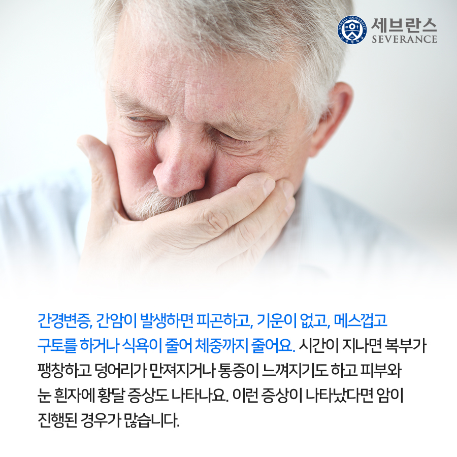 간경변증, 간암이 발생하면 피곤하고, 기운이 없고, 메스껍고 구토를 하거나 식욕이 줄어 체중까지 줄어요. 시간이 지나면 복부가 팽창하고 덩어리가 만져지거나 통증이 느껴지기도 하고 피부와 눈 흰자에 황달 증상도 나타나1요. 이런 증상이 나타났다면 암이 진행된 경우가 많습니다.