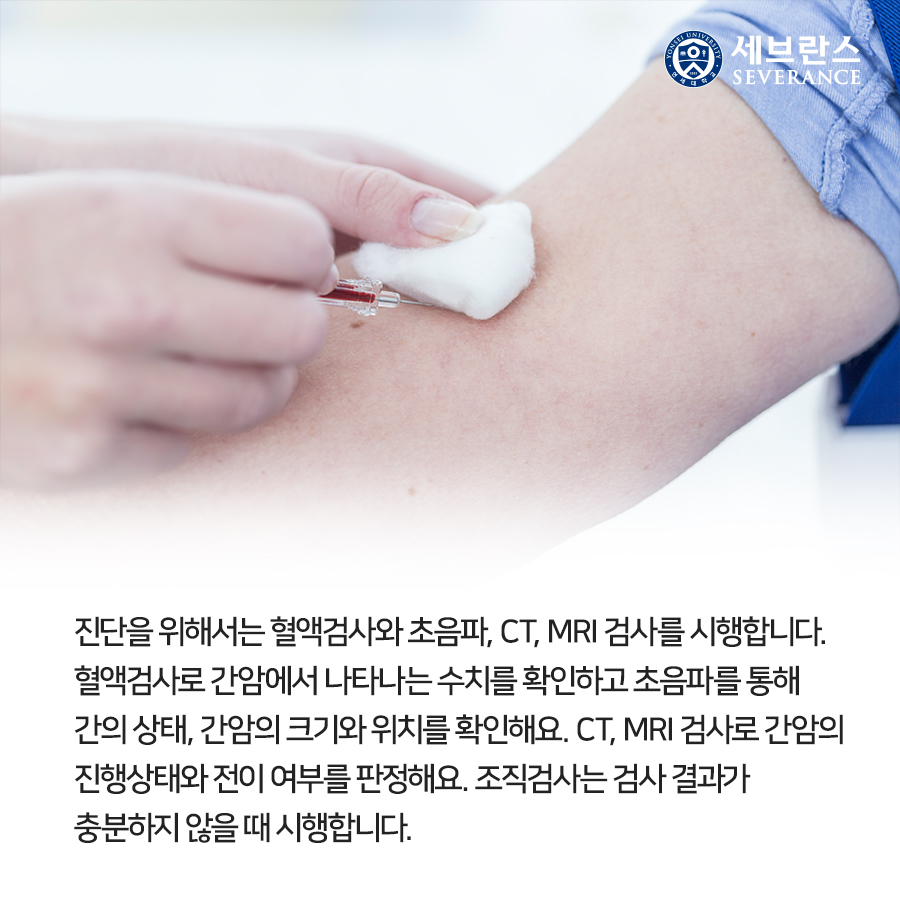 진단을 위해서는 혈액검사와 초음파, CT, MRI 검사를 시행합니다. 혈액검사로 간암에서 나타나는 수치를 확인하고 초음파를 통해 간의 상태, 간암의 크기와 위치를 확인해요. CT, MRI 검사로 간암의 진행상태와 전이 여부를 판정해요. 조직검사는 검사 결과가 충분하지 않을 때 시행합니다.