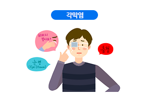 각막염