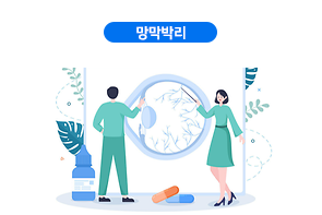 망막박리